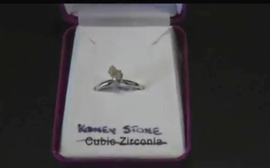 Kidney Stone ring