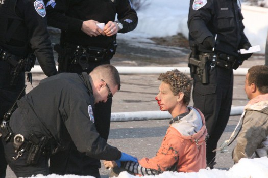 Two victims were injured in the explosion.