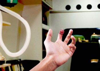 Derwood Hodgegrass shared this sefie after losing his fingertip on Sunday