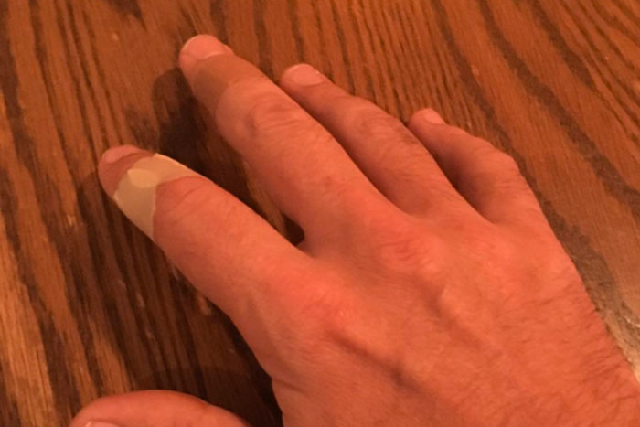 Jimmy Fallon injures a finger, again!