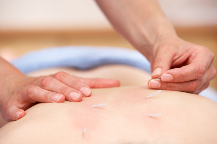 Trust the best of the best acupuncturists.