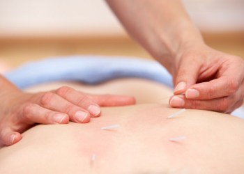 Trust the best of the best acupuncturists.