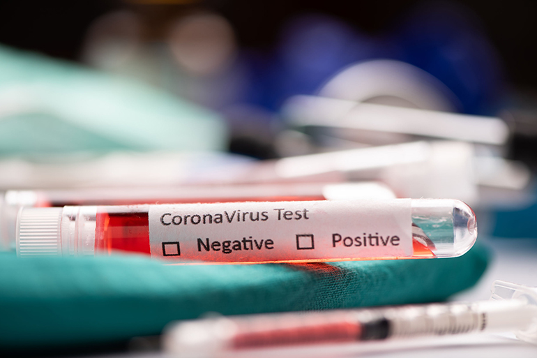 2019-nCoV. Coronavirus blood test in Laboratory Coronavirus test