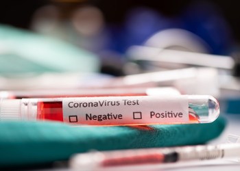 2019-nCoV. Coronavirus blood test in Laboratory Coronavirus test