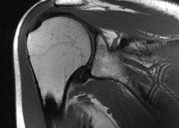 SB-Tesla-MRI-2