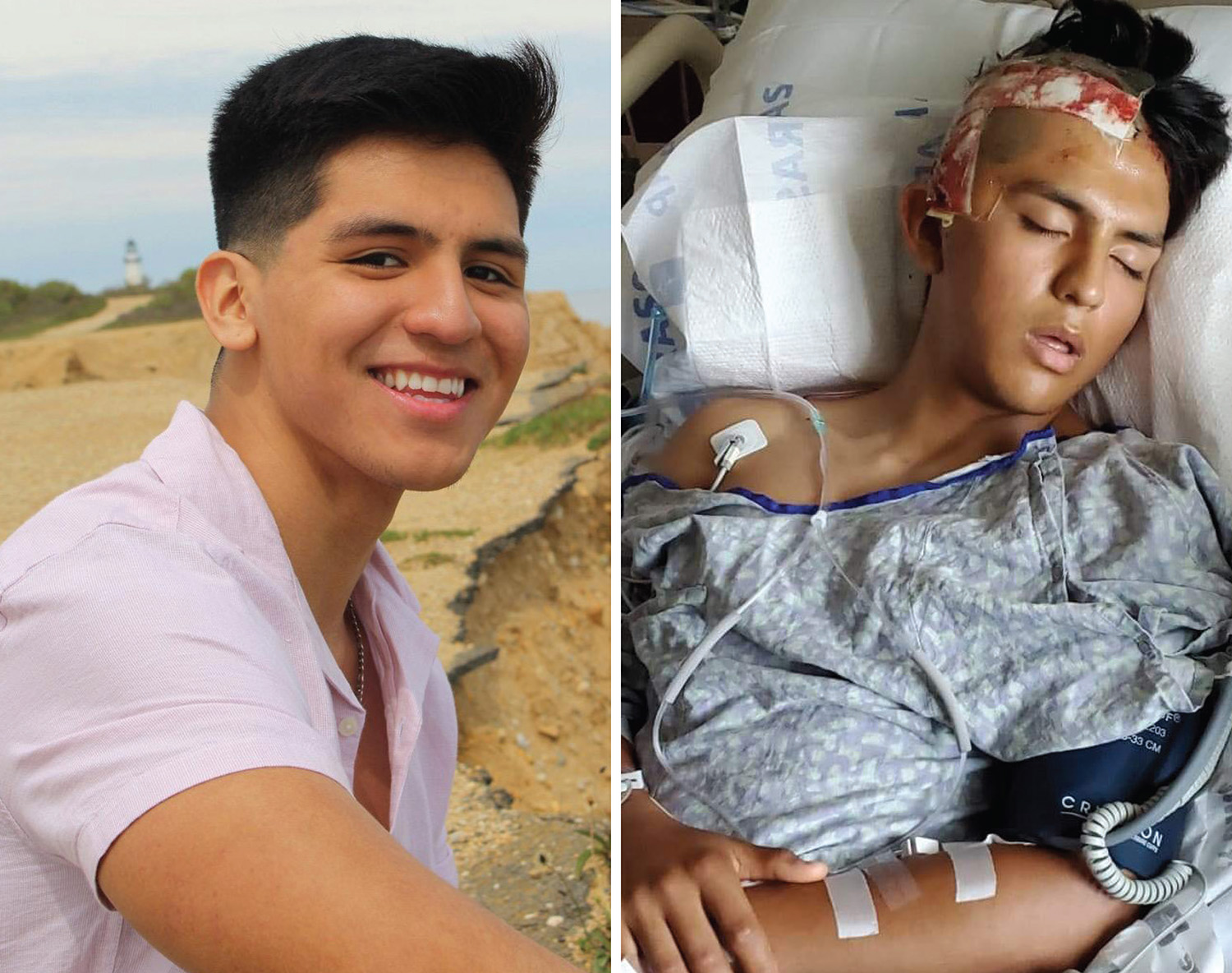 Meryl Streep's nephew Charles Streep's alleged victim David Peralta-Mera before the attack, at left, and afterwards, at right.