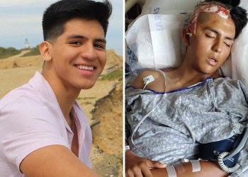 Meryl Streep's nephew Charles Streep's alleged victim David Peralta-Mera before the attack, at left, and afterwards, at right.