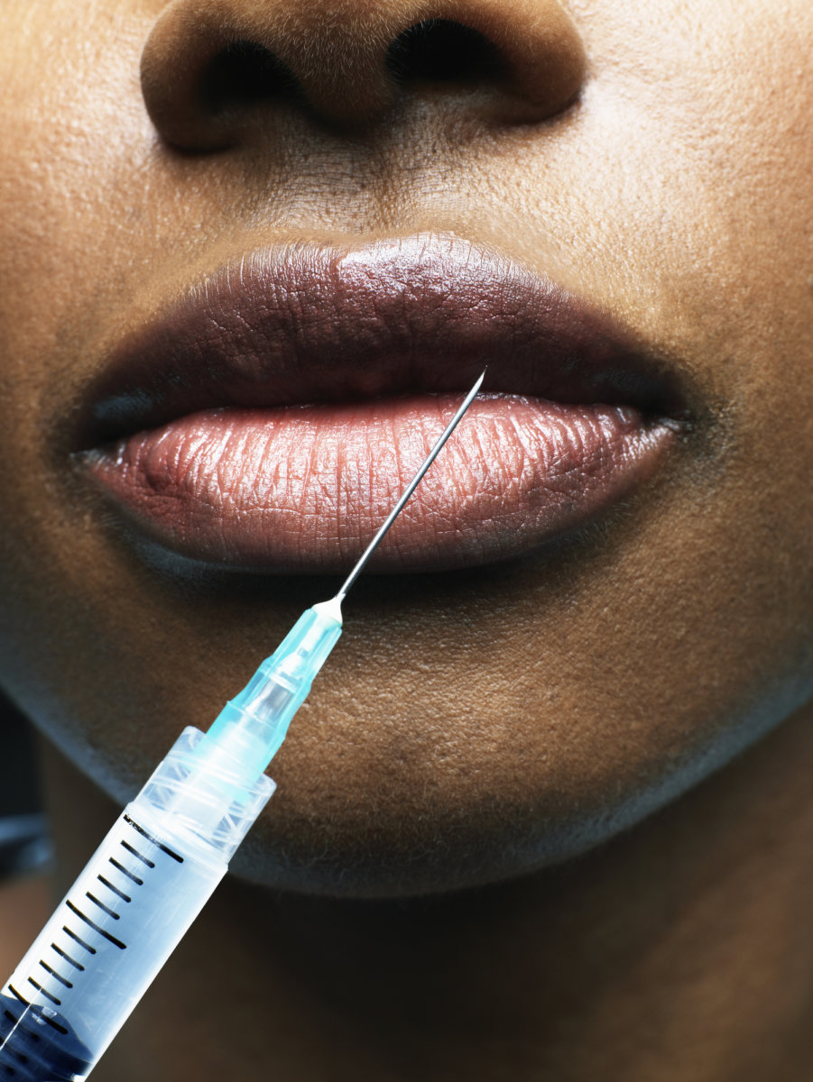 Young woman receiving lip injection makeover