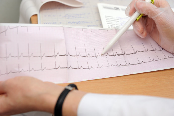 Get tested to protect yourself against an undiagnosed aortic aneurysm and other heart health problems