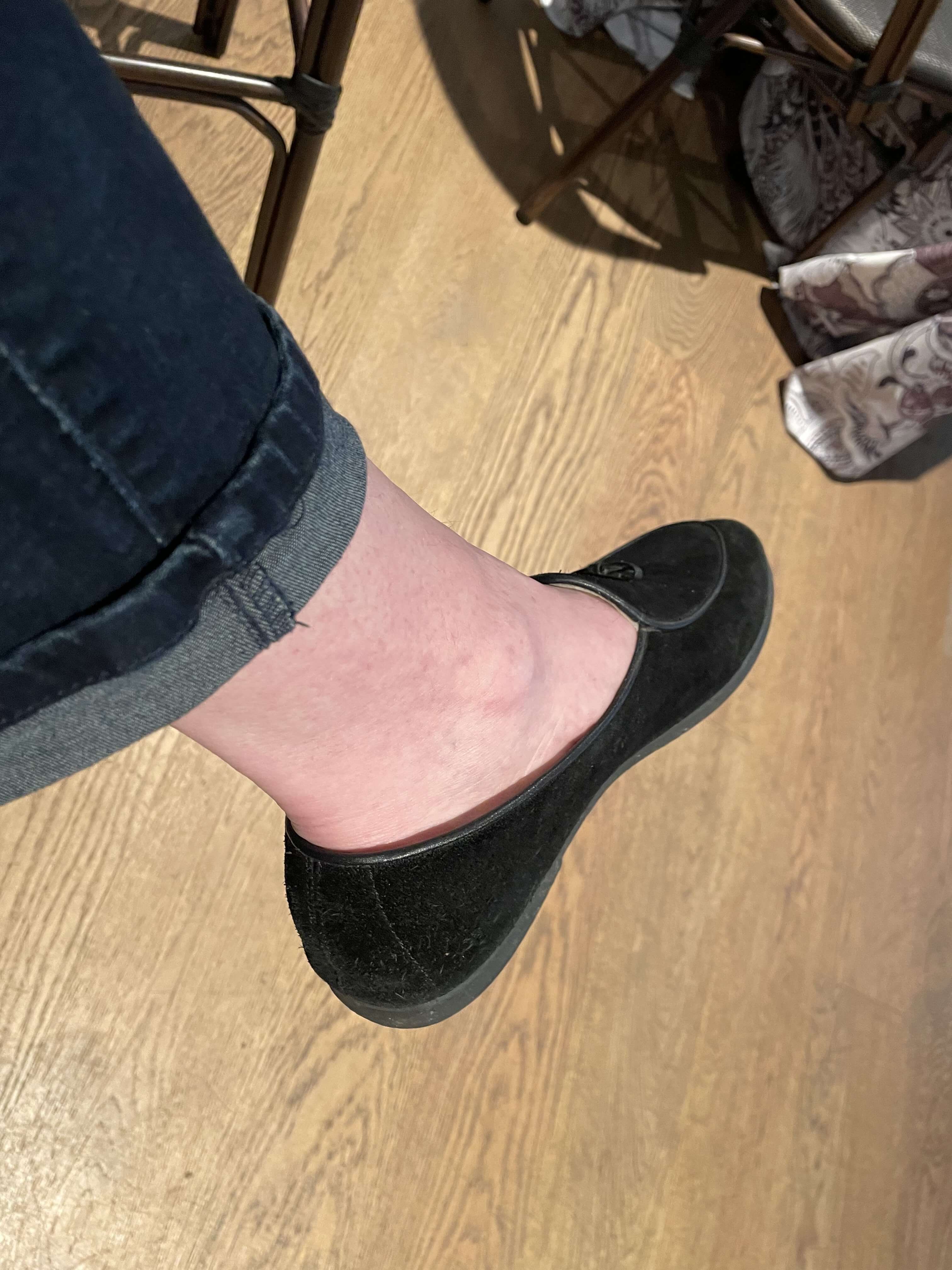 Male cankles table for one, please…