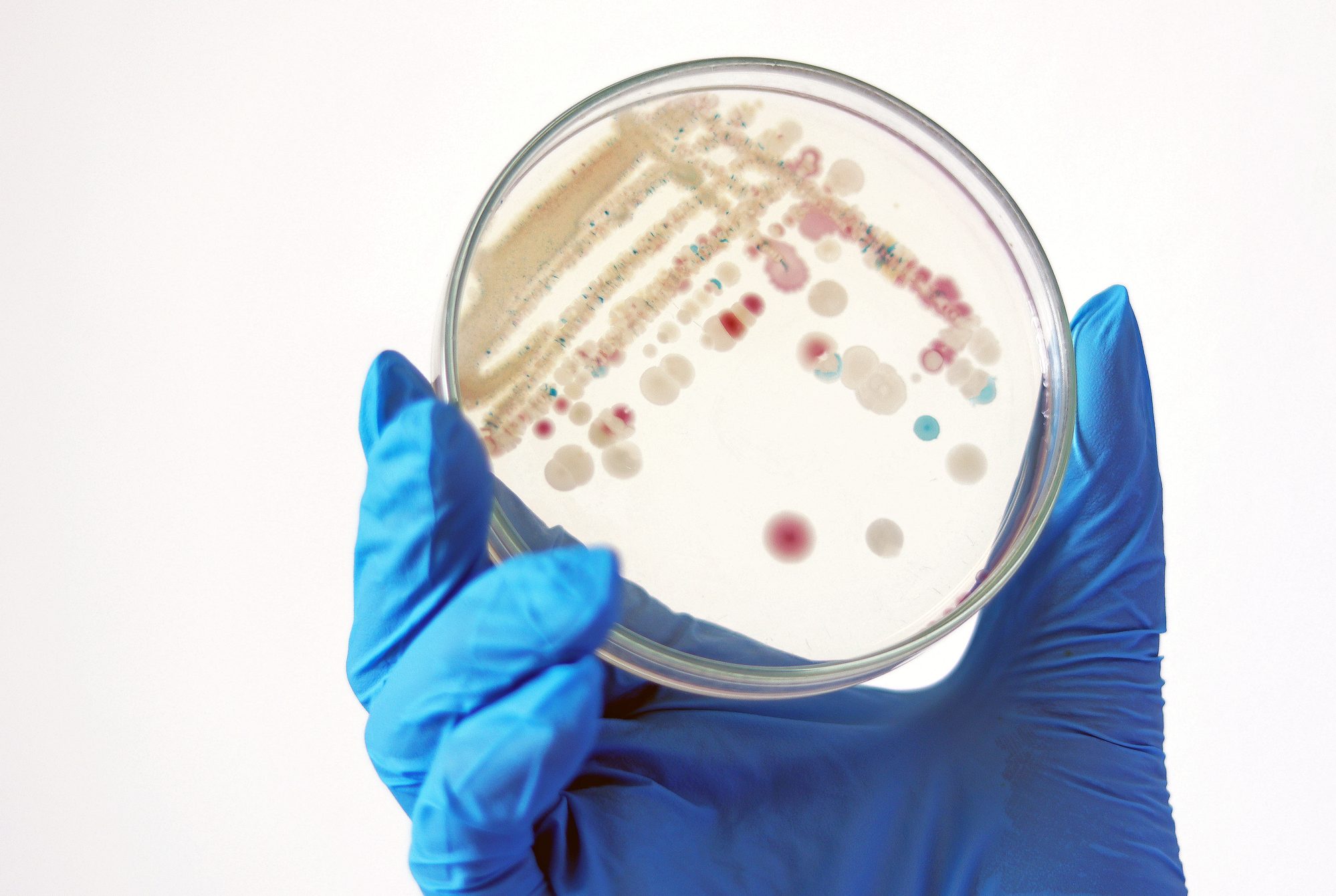 Researcher is holding Petri dish of Vibrio vulnificus in CHROMagar and TCBS, an estuarine bacterium which occurs in in filter-feeding molluscan shellfish, such as oysters., ingestion of the bacterium. (Getty Images)