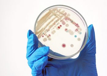 Researcher is holding Petri dish of Vibrio vulnificus in CHROMagar and TCBS, an estuarine bacterium which occurs in in filter-feeding molluscan shellfish, such as oysters., ingestion of the bacterium. (Getty Images)