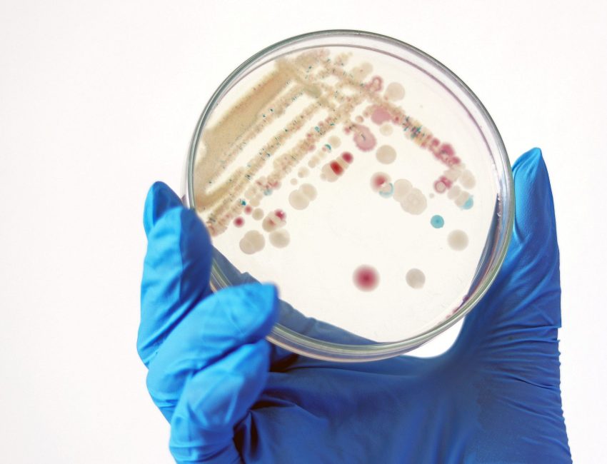 Researcher is holding Petri dish of Vibrio vulnificus in CHROMagar and TCBS, an estuarine bacterium which occurs in in filter-feeding molluscan shellfish, such as oysters., ingestion of the bacterium. (Getty Images)